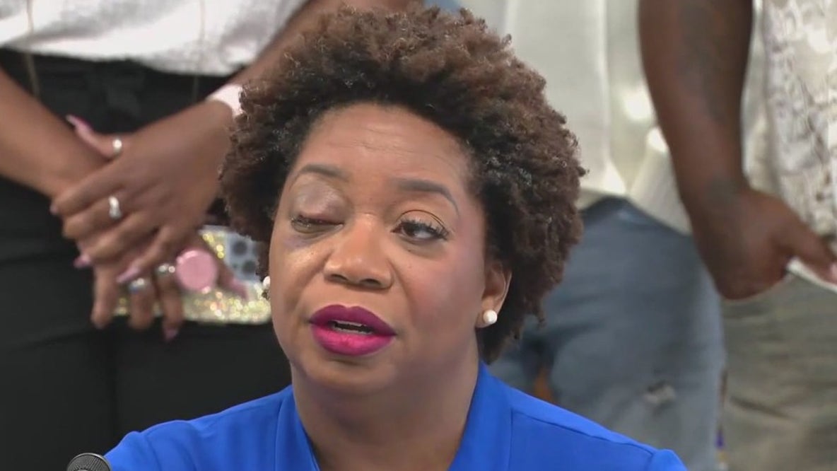Assistant principal may lose eye after assault